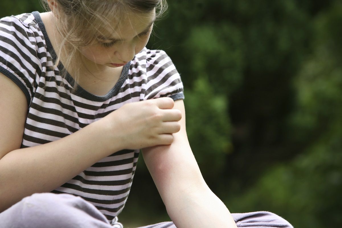 girl with mosquito bite, scratching hand has motion blur